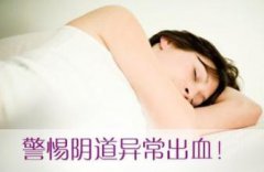 非经期出血